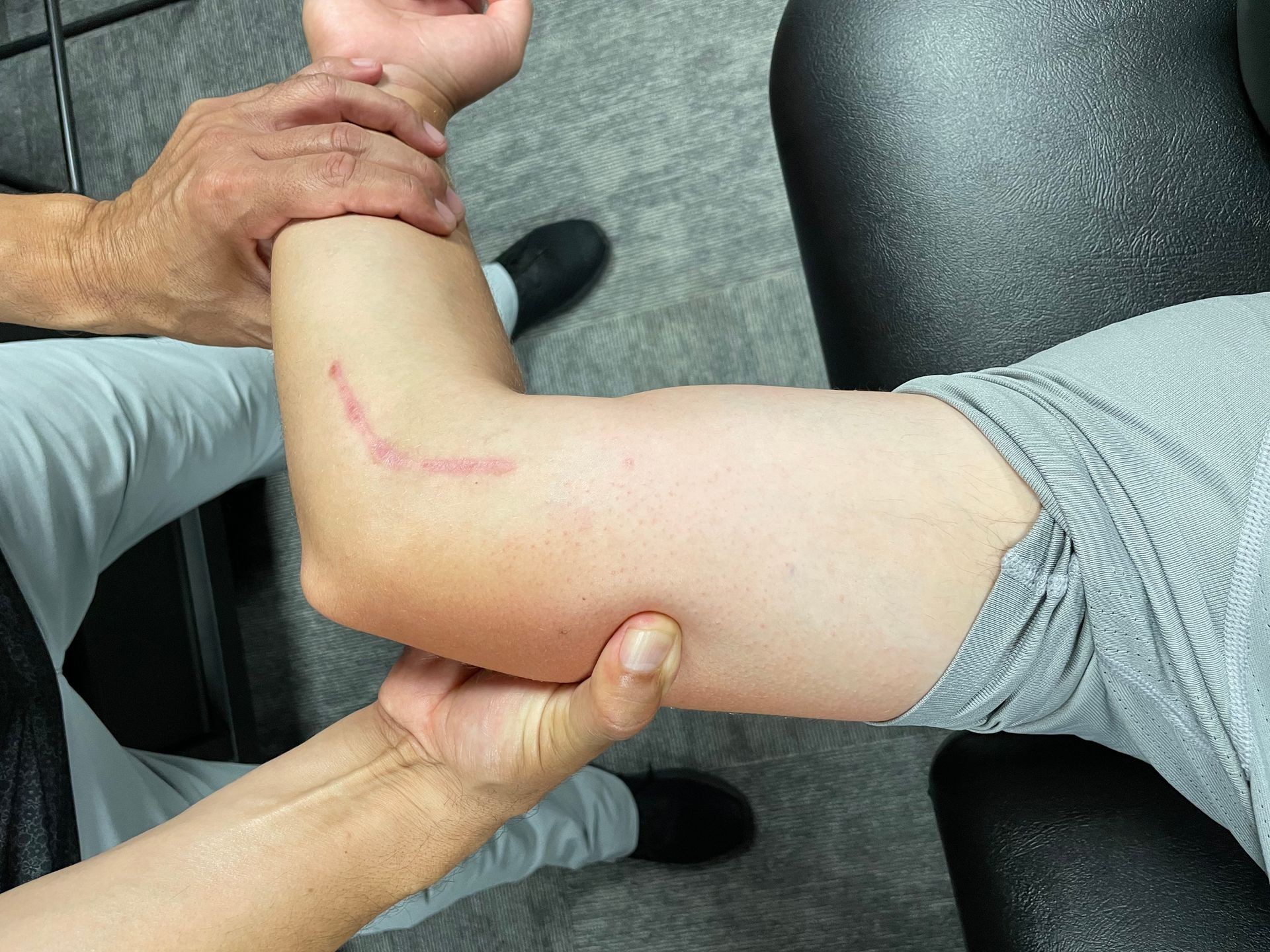 Postoperative Rehab